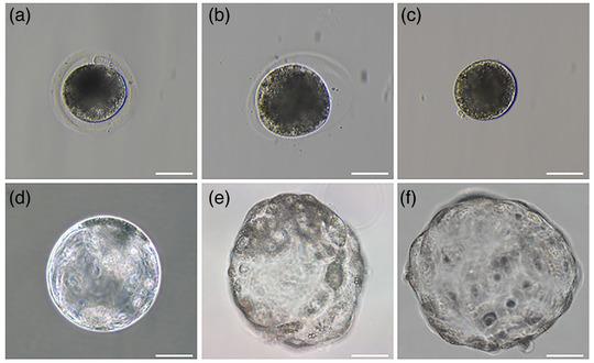 https://cdn.ncbi.nlm.nih.gov/pmc/blobs/2410/8788957/51a39ce8ebd9/VMS3-8-164-g002.jpg