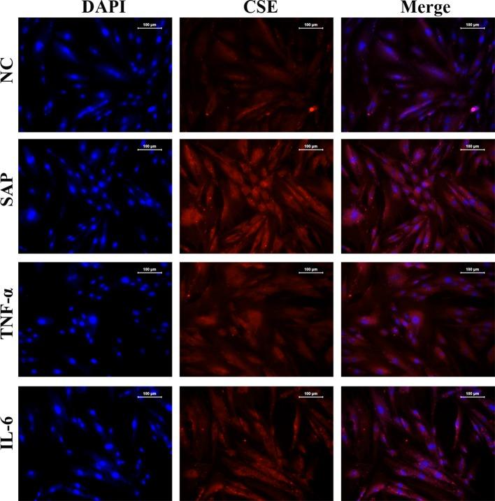 https://cdn.ncbi.nlm.nih.gov/pmc/blobs/2412/5408656/bff166e31b35/bsr-2016-0483i006.jpg