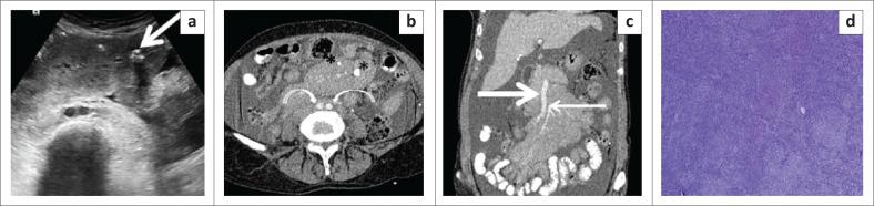 https://cdn.ncbi.nlm.nih.gov/pmc/blobs/2415/10244954/12ec2b718bb0/SAJR-27-2595-g011.jpg