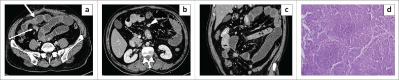 https://cdn.ncbi.nlm.nih.gov/pmc/blobs/2415/10244954/86c88273168a/SAJR-27-2595-g010.jpg