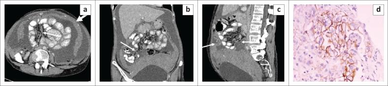 https://cdn.ncbi.nlm.nih.gov/pmc/blobs/2415/10244954/959d59ea45e4/SAJR-27-2595-g004.jpg