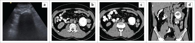 https://cdn.ncbi.nlm.nih.gov/pmc/blobs/2415/10244954/d183e9dffd19/SAJR-27-2595-g003.jpg