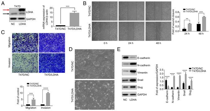 https://cdn.ncbi.nlm.nih.gov/pmc/blobs/2415/10914311/26202a98ac8e/ijmm-53-04-05364-g05.jpg
