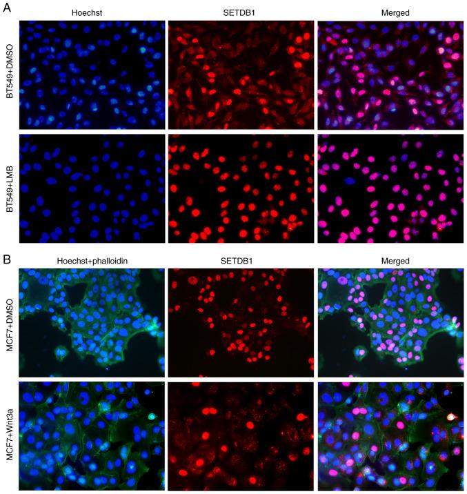 https://cdn.ncbi.nlm.nih.gov/pmc/blobs/2415/10914311/46ae59fd0bff/ijmm-53-04-05364-g01.jpg