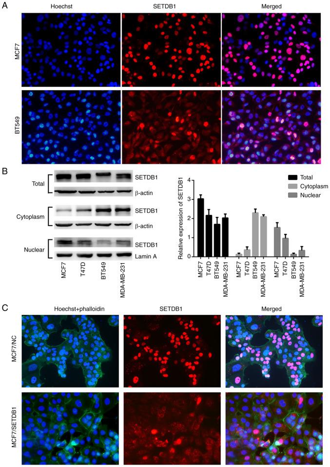 https://cdn.ncbi.nlm.nih.gov/pmc/blobs/2415/10914311/4be3df6d1cb5/ijmm-53-04-05364-g00.jpg