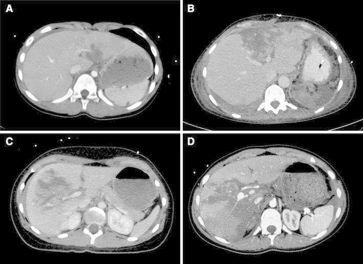 https://cdn.ncbi.nlm.nih.gov/pmc/blobs/2415/3898124/2b9360b57db4/595_2013_515_Fig2_HTML.jpg