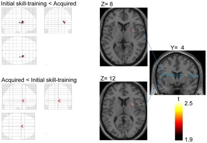 https://cdn.ncbi.nlm.nih.gov/pmc/blobs/241d/3280327/c2261a9a72fc/pone.0031728.g005.jpg