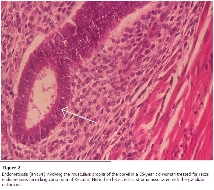 https://cdn.ncbi.nlm.nih.gov/pmc/blobs/2424/3240923/c445793724a7/PAMJ-10-33-g002.jpg