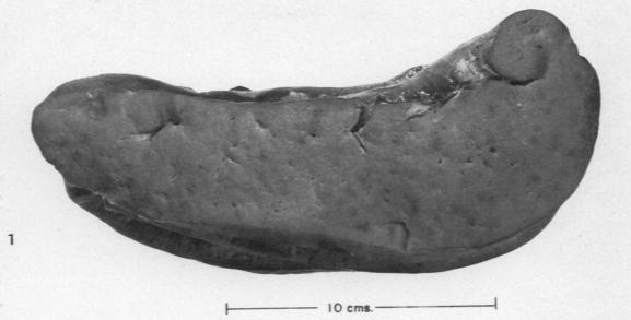 https://cdn.ncbi.nlm.nih.gov/pmc/blobs/2426/1934287/74e7578014db/amjpathol00500-0031-a.jpg