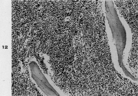 https://cdn.ncbi.nlm.nih.gov/pmc/blobs/2426/1934287/ad17657492fa/amjpathol00500-0041-a.jpg