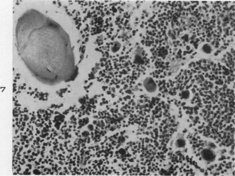 https://cdn.ncbi.nlm.nih.gov/pmc/blobs/2426/1934287/b2f0ba30bdc0/amjpathol00500-0035-b.jpg