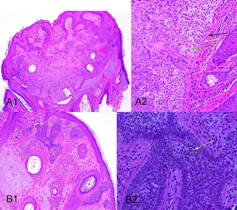 https://cdn.ncbi.nlm.nih.gov/pmc/blobs/2427/4462900/7608c76abd1a/dp0502a08g003.jpg