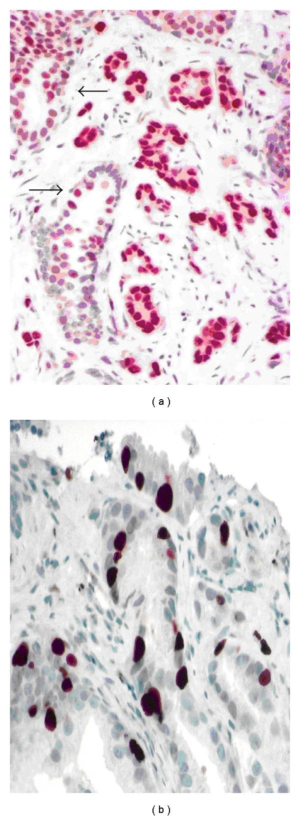 https://cdn.ncbi.nlm.nih.gov/pmc/blobs/242b/3200271/8f71d7bc271c/PC2012-593241.002.jpg
