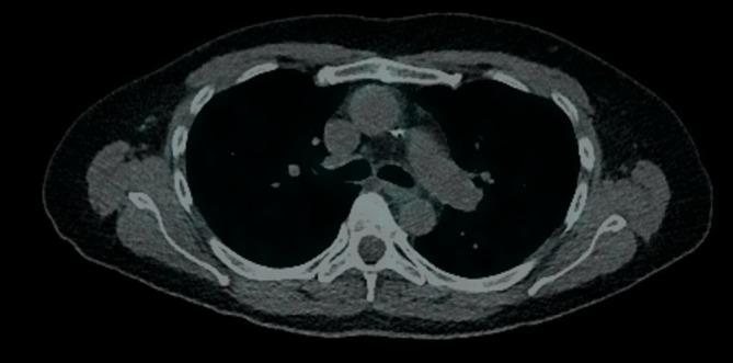 https://cdn.ncbi.nlm.nih.gov/pmc/blobs/242e/12231209/3ab788f09688/RCR2-13-e70265-g003.jpg