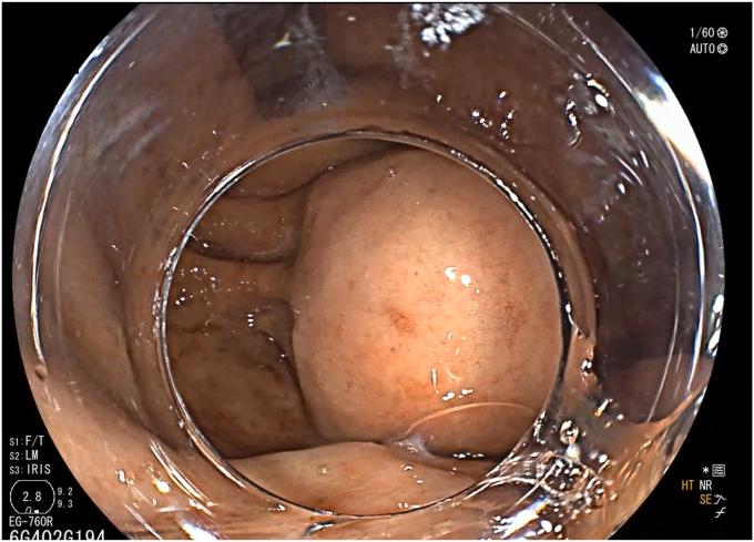 https://cdn.ncbi.nlm.nih.gov/pmc/blobs/242e/12237737/dc043ad48ea4/gr2.jpg