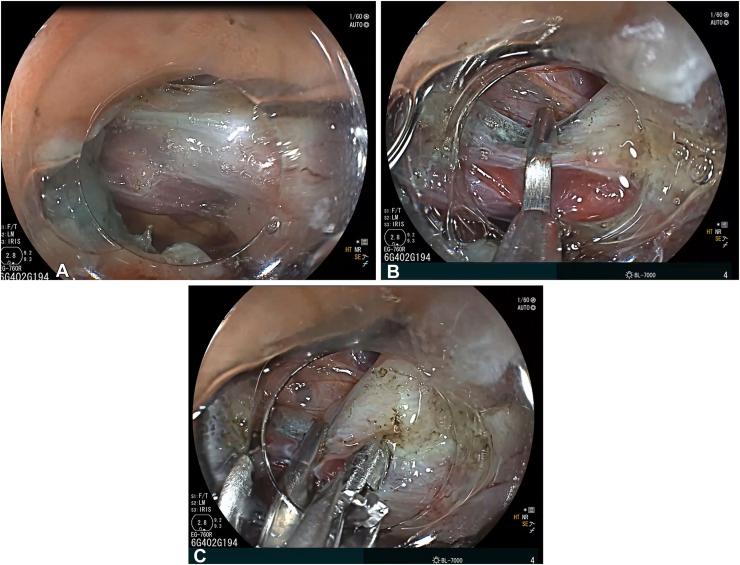 https://cdn.ncbi.nlm.nih.gov/pmc/blobs/242e/12237737/e4212367c216/gr4.jpg