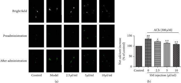 https://cdn.ncbi.nlm.nih.gov/pmc/blobs/2431/7787763/bdb80b22399e/ECAM2020-8514926.003.jpg