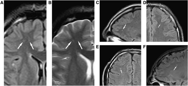 https://cdn.ncbi.nlm.nih.gov/pmc/blobs/2435/4249716/08d1cde116cd/13024_2013_546_Fig7_HTML.jpg