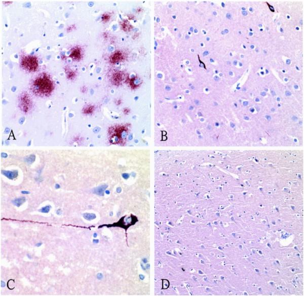 https://cdn.ncbi.nlm.nih.gov/pmc/blobs/2435/4249716/0daf9db5e8f4/13024_2013_546_Fig3_HTML.jpg