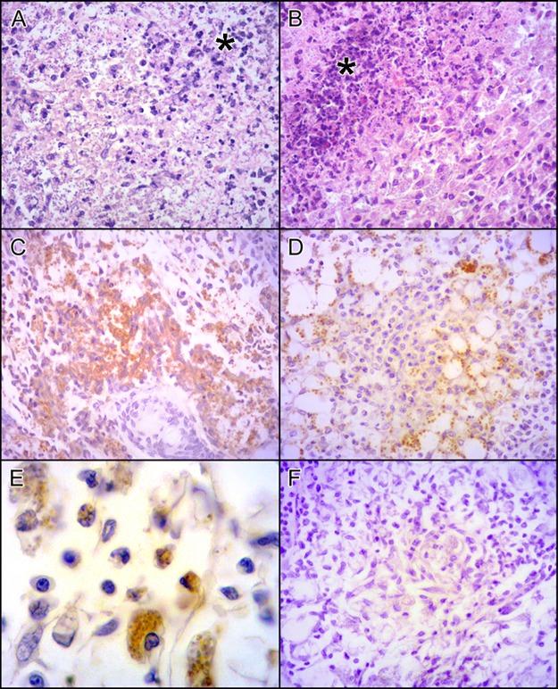 https://cdn.ncbi.nlm.nih.gov/pmc/blobs/2437/5720813/d761db90ab71/pntd.0006090.g002.jpg