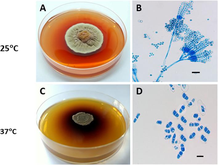 https://cdn.ncbi.nlm.nih.gov/pmc/blobs/243a/12141349/82830fd7b483/fcimb-15-1591429-g002.jpg