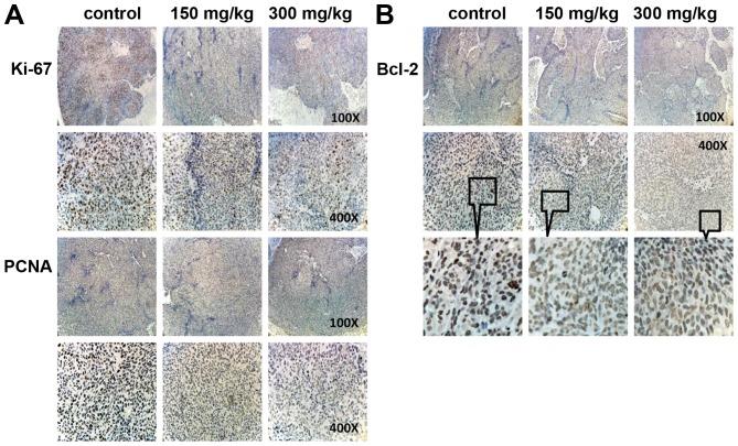 https://cdn.ncbi.nlm.nih.gov/pmc/blobs/2440/5403400/c6b198d350c6/IJO-50-05-1541-g05.jpg