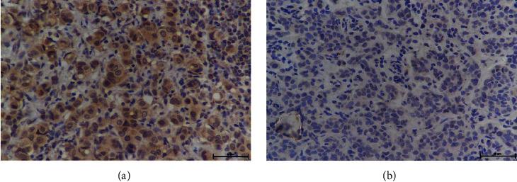 https://cdn.ncbi.nlm.nih.gov/pmc/blobs/2440/9410952/e2f69808551b/JO2022-8675705.001.jpg