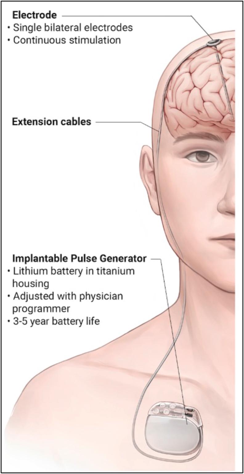 https://cdn.ncbi.nlm.nih.gov/pmc/blobs/2444/11103220/c13f393f4b8d/gr2.jpg