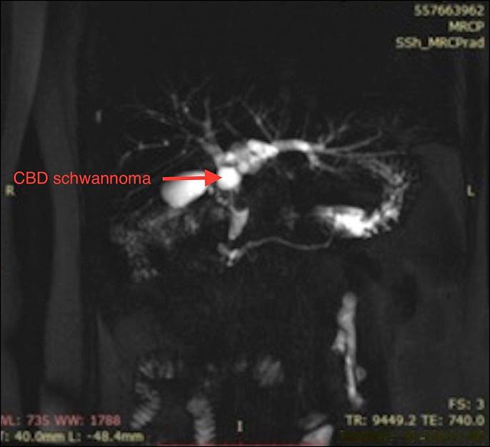 https://cdn.ncbi.nlm.nih.gov/pmc/blobs/2446/6855524/2a50c1420358/ac9-6-e00223-g001.jpg