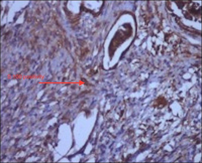 https://cdn.ncbi.nlm.nih.gov/pmc/blobs/2446/6855524/700362c321a9/ac9-6-e00223-g004.jpg