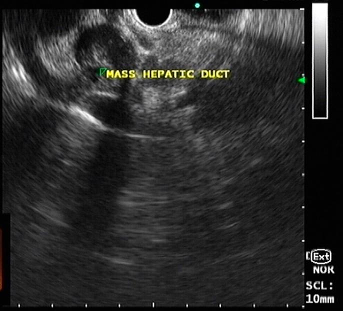 https://cdn.ncbi.nlm.nih.gov/pmc/blobs/2446/6855524/eb5e0c600f29/ac9-6-e00223-g002.jpg