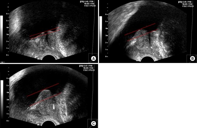 https://cdn.ncbi.nlm.nih.gov/pmc/blobs/2448/2963782/6d6d7a90faa0/kju-51-694-g001.jpg