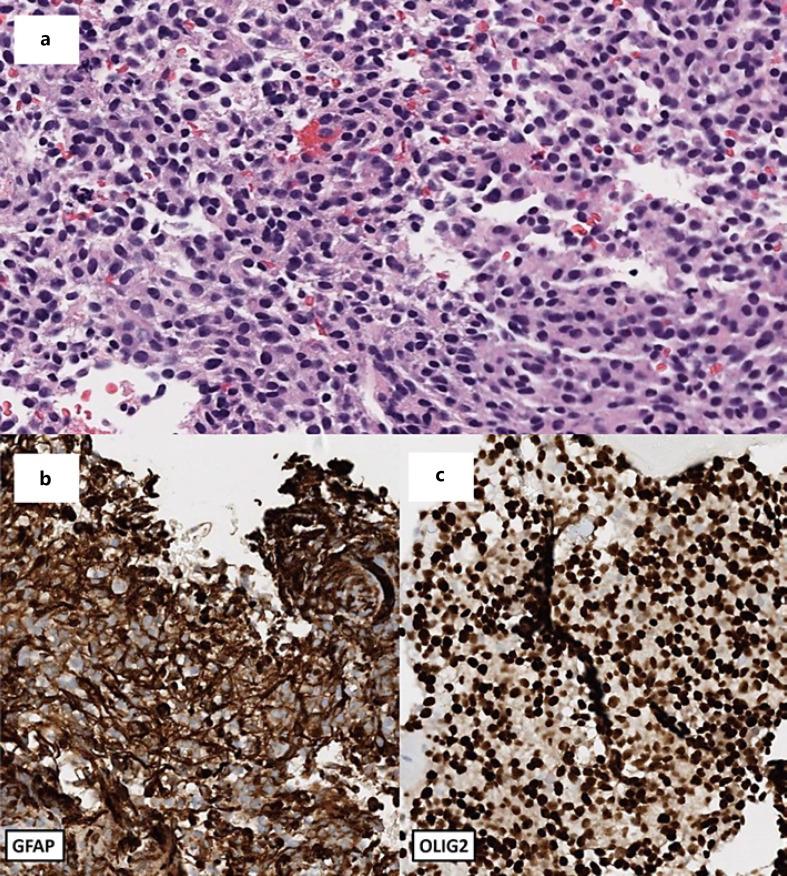 https://cdn.ncbi.nlm.nih.gov/pmc/blobs/244f/9941771/c90814728357/cro-0015-0909-g01.jpg