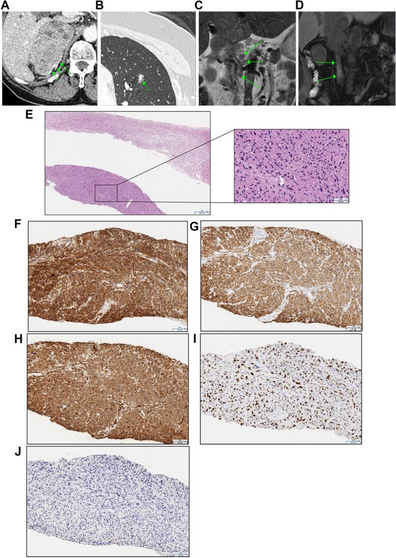 https://cdn.ncbi.nlm.nih.gov/pmc/blobs/2450/10726553/b81ae1257e42/12902_2023_1530_Fig1_HTML.jpg