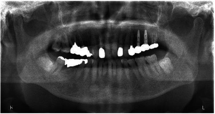 https://cdn.ncbi.nlm.nih.gov/pmc/blobs/2450/12375442/7f914fbe0bf3/cureus-0017-00000088768-i01.jpg