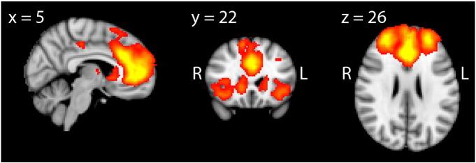 https://cdn.ncbi.nlm.nih.gov/pmc/blobs/2450/3566589/d2e67c391050/gr1.jpg