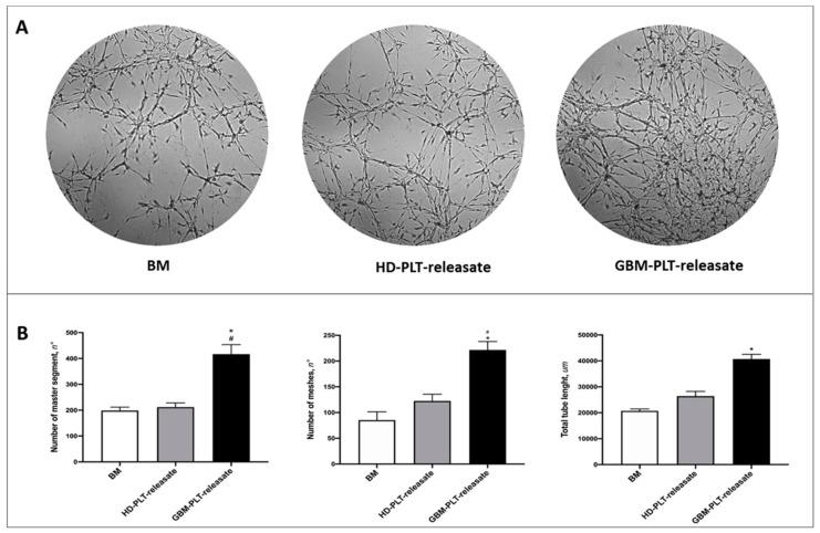 https://cdn.ncbi.nlm.nih.gov/pmc/blobs/2453/7072723/09cc92314fe9/cells-09-00294-g005.jpg