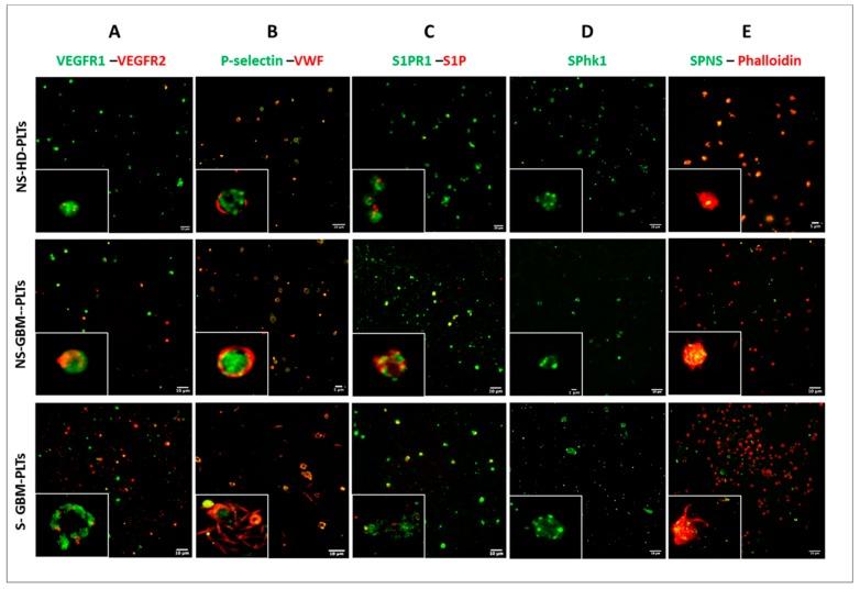 https://cdn.ncbi.nlm.nih.gov/pmc/blobs/2453/7072723/bdb28ba59b35/cells-09-00294-g002.jpg