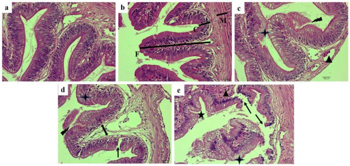 https://cdn.ncbi.nlm.nih.gov/pmc/blobs/2457/9570327/e6003cb99037/ijms-23-11198-g001.jpg