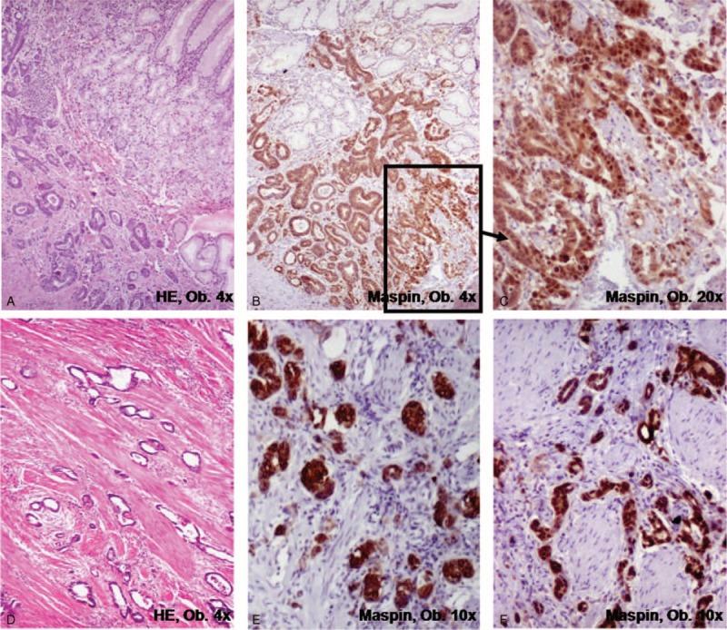 https://cdn.ncbi.nlm.nih.gov/pmc/blobs/2459/4620773/e5020cda6d6c/medi-94-e1810-g004.jpg