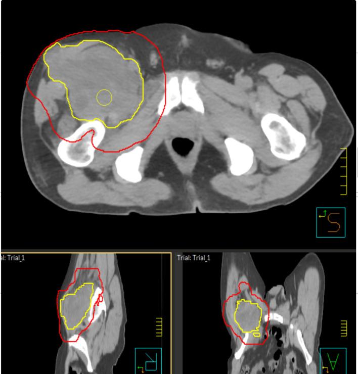 https://cdn.ncbi.nlm.nih.gov/pmc/blobs/245c/8702420/8b6999954743/590_2021_2990_Fig2_HTML.jpg