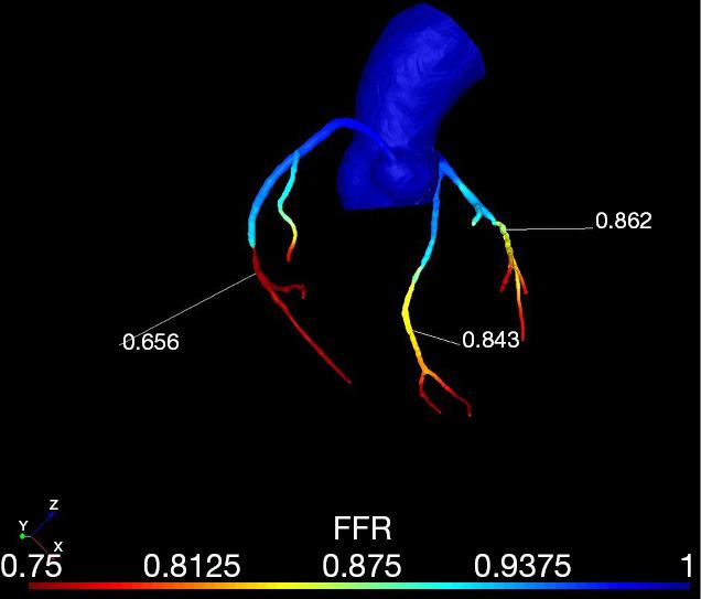 https://cdn.ncbi.nlm.nih.gov/pmc/blobs/245d/9073792/a7250e7643d4/atm-10-07-412-f2.jpg