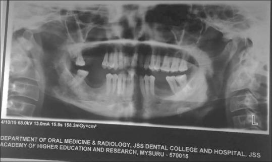 https://cdn.ncbi.nlm.nih.gov/pmc/blobs/245f/10112703/abfde63ba2b1/JOMFP-27-98-g002.jpg