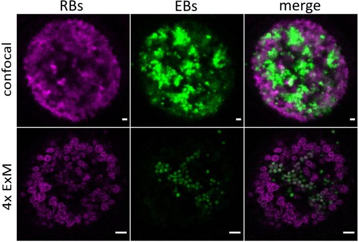 https://cdn.ncbi.nlm.nih.gov/pmc/blobs/2460/6695470/b635eccd254d/fcimb-09-00276-g0002.jpg