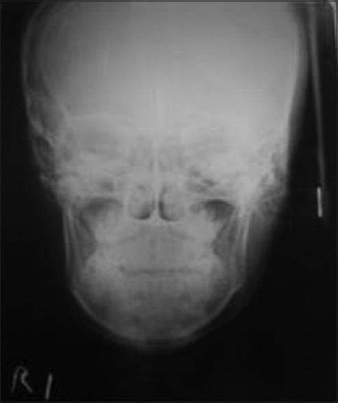 https://cdn.ncbi.nlm.nih.gov/pmc/blobs/246d/5512411/1a8483807a6a/NJMS-8-58-g012.jpg