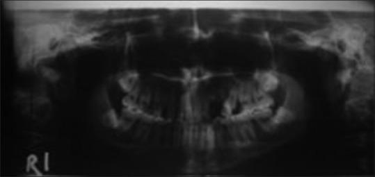 https://cdn.ncbi.nlm.nih.gov/pmc/blobs/246d/5512411/4aacb9b16c66/NJMS-8-58-g008.jpg