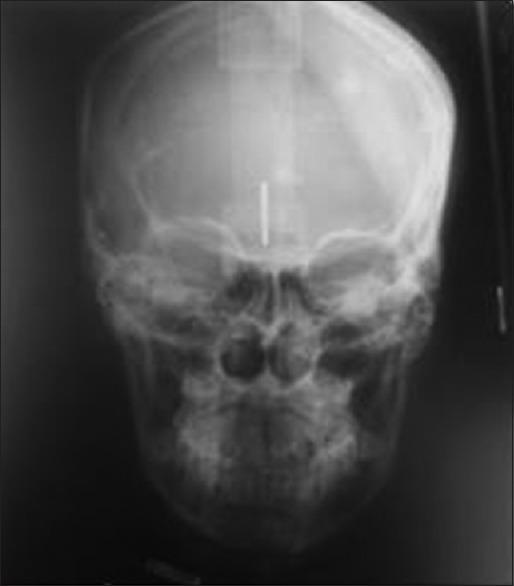 https://cdn.ncbi.nlm.nih.gov/pmc/blobs/246d/5512411/555b414f8727/NJMS-8-58-g007.jpg