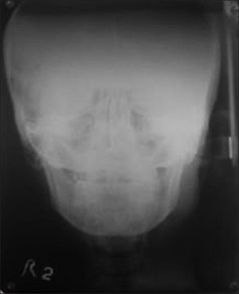 https://cdn.ncbi.nlm.nih.gov/pmc/blobs/246d/5512411/71fa17b7794a/NJMS-8-58-g015.jpg