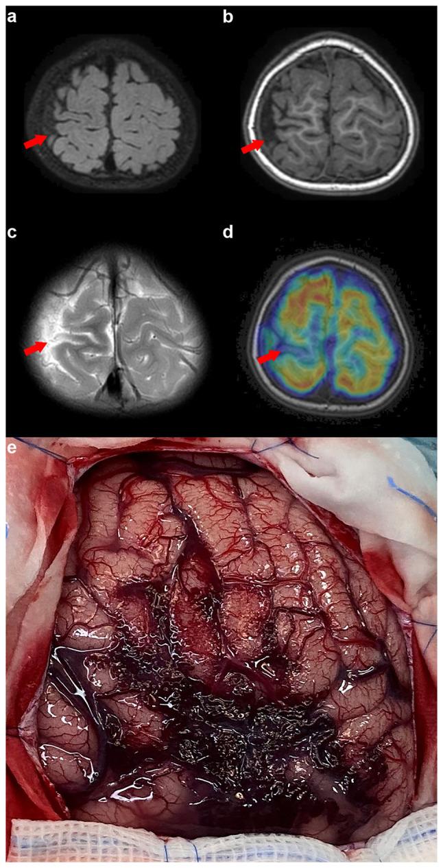 https://cdn.ncbi.nlm.nih.gov/pmc/blobs/246f/11168029/0e3722589653/etm-28-01-12588-g03.jpg