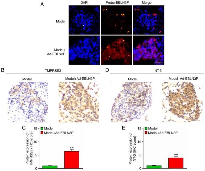 https://cdn.ncbi.nlm.nih.gov/pmc/blobs/2478/7169660/7a392becdc75/IJMM-45-06-1851-g05.jpg